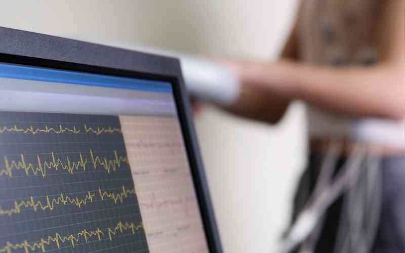 arritmia-cardiaca-exercicios-fisicos